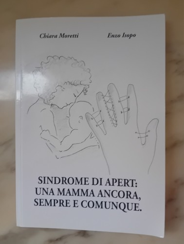 Libro sindrome apert una - sindrome,